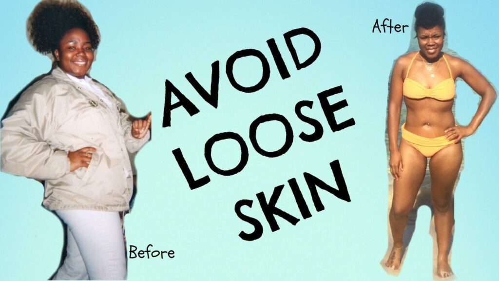 How Can I Prevent Loose Skin During Weight Loss